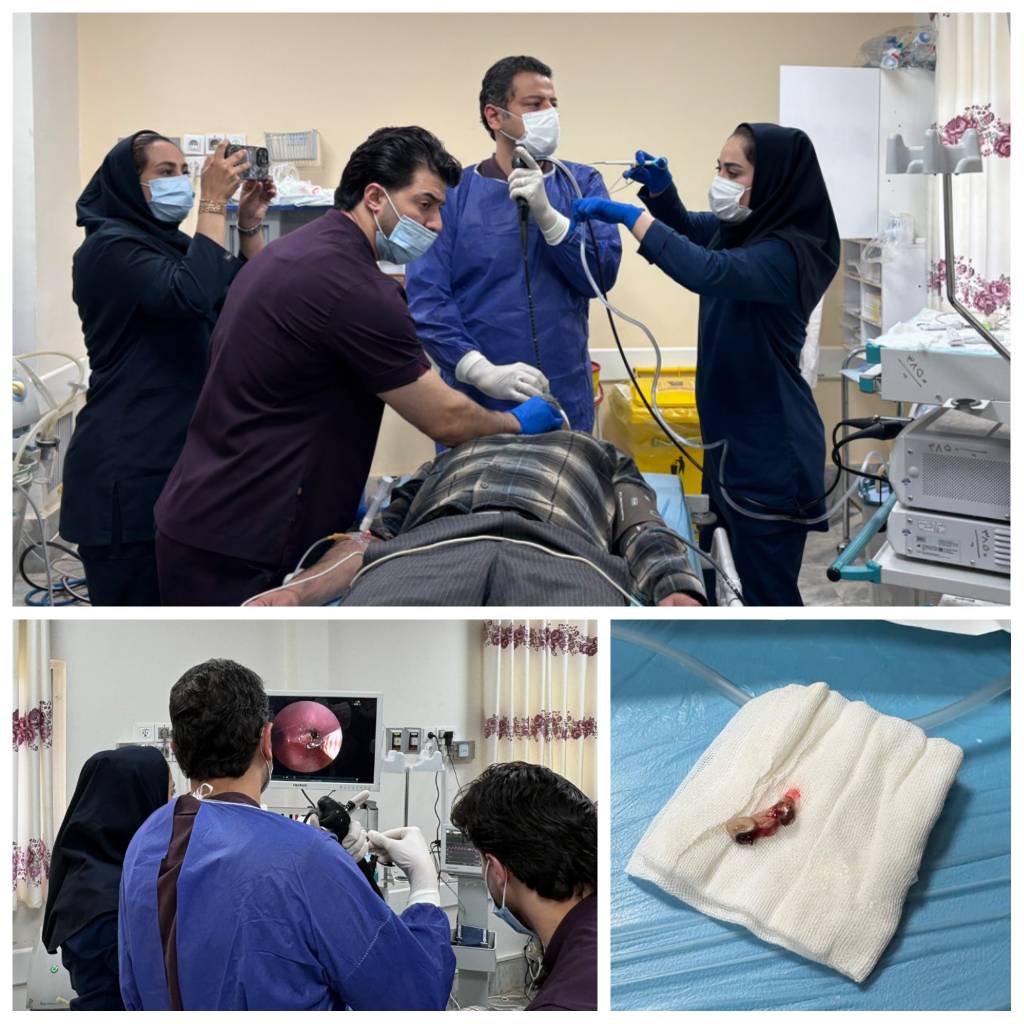 موفقیت در اولین عملیات برونکوسکوپی اورژانسی در تاریخ نیشابور؛ نجات جان بیمار از خطر مرگ