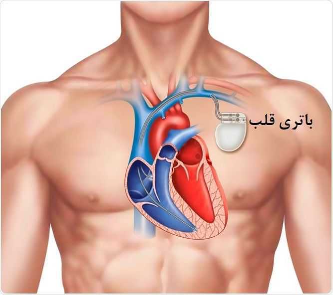 قلب
