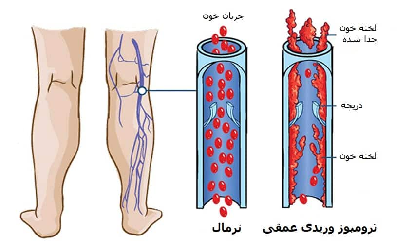 داخلی و گوارش